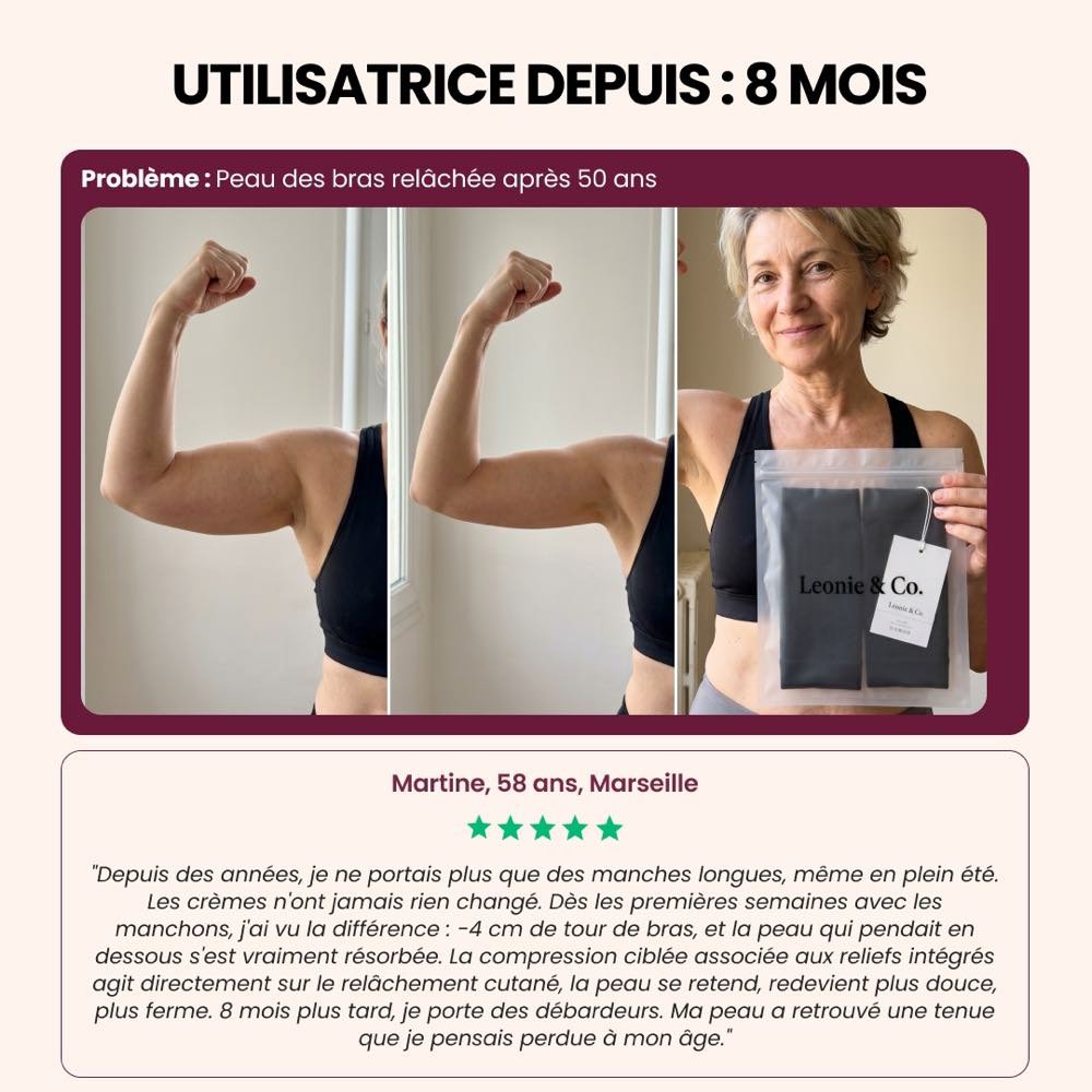 Avis de Martine, 58 ans, Marseille, après huit mois avec les manchons sculptants 3D